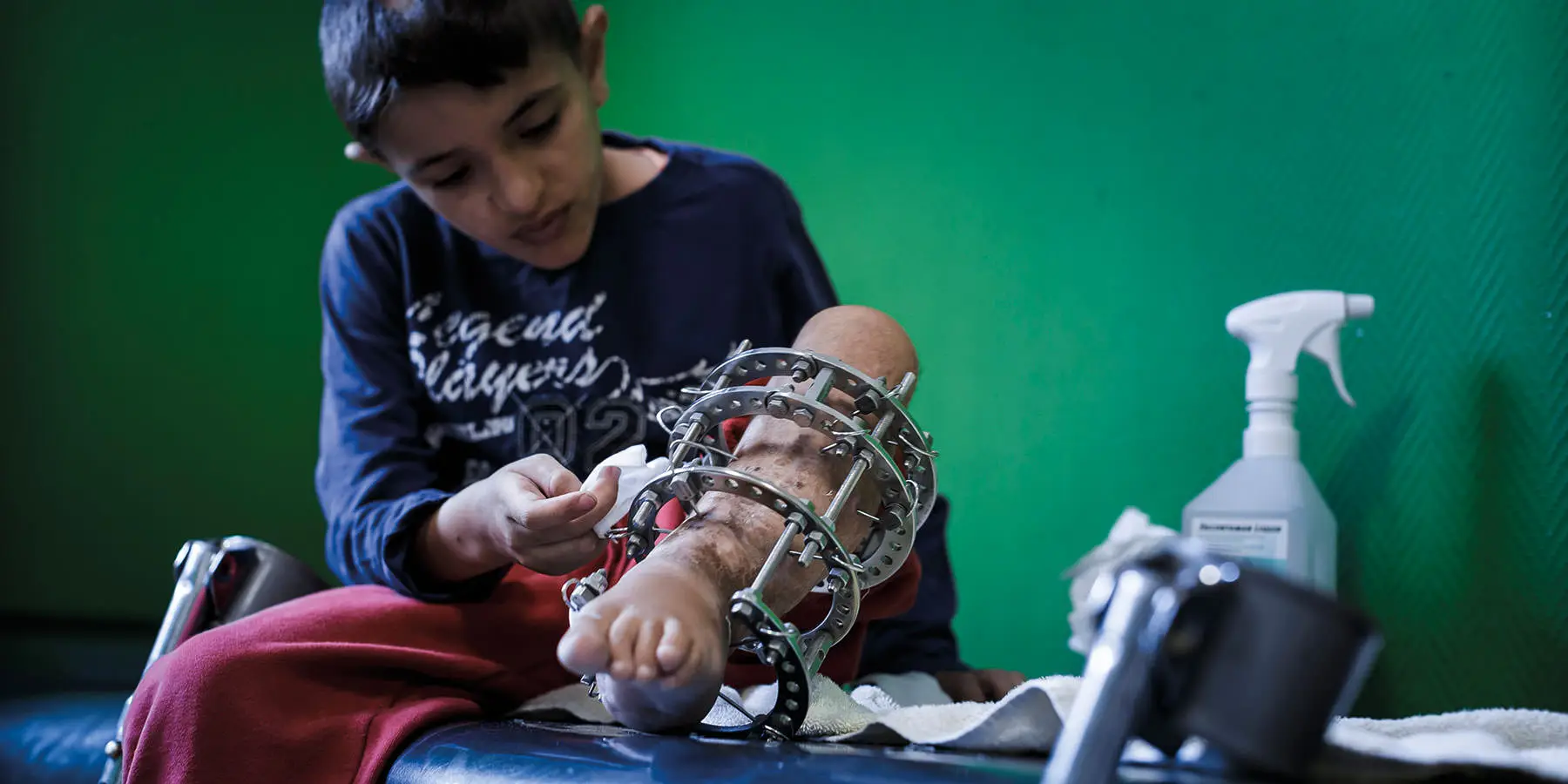 Friedensdorf International – Bild 2